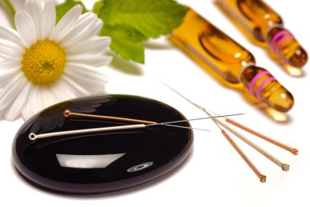 De ce acupunctura poate fi benefica in unele probleme de sanatate