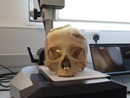 Un craniu egiptean vechi de 4.000 de ani dezvaluie indicii despre posibile tratamente impotriva cancerului