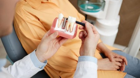 Garantia implantului dentar: Asumarea interventiei medicale