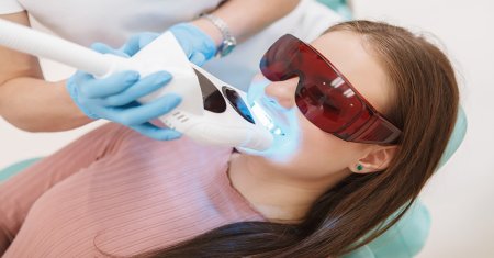 Albire dentara cu laser: Procedura sigura si eficienta pentru un zambet stralucitor