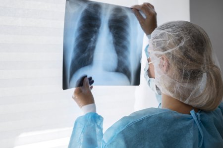Cancerul pulmonar: Noi terapii prezentate la ASCO 2024 de la <span style='background:#EDF514'>CHICAGO</span>
