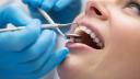 Cand e nevoie de fatete dentare. Reabilitarea orala se poate face in 24 de ore