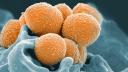 O bacterie rara care poate provoca moartea in 48 de ore se raspandeste in Japonia