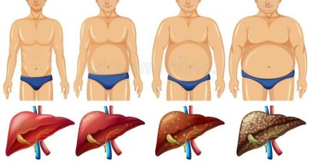 Un nou tip de tratament al tumorii hepatice este realizabil si in Romania. Cu ani in urma, acest diagnostic insemna automat o condamnare la moarte