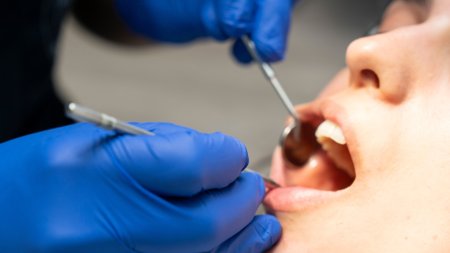 Managerul unei clinici stomatologice a introdus Casco dentar. Pretul este de 80 de lei pe luna