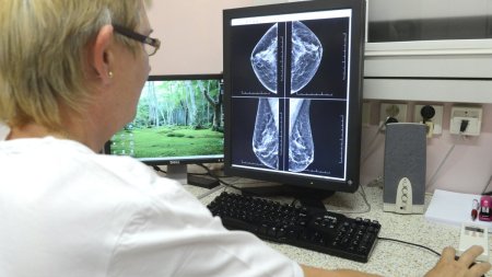 O doctorita radiolog de la Spitalul Judetean din Oradea este cercetata disciplinar, dupa ce colegii s-au plans ca ii hartuieste sexual. Femeia ar fi pus si diagnostice gresite la cativa pacienti