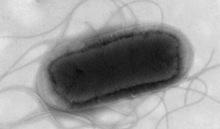 Focar mortal de E.coli in Marea Britanie: cel putin un deces din cauza unei variante periculoase a bacteriei