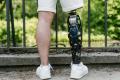 Un studiu arata ca piciorul bionic face mersul mai rapid si mai usor pentru persoanele cu amputatii