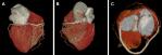 In premiera, cartografierea 3D a inimii pana la nivel de celula