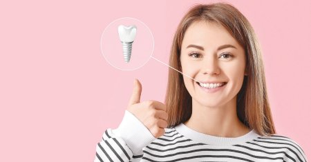 Totul despre implantul dentar! 4 raspunsuri la cele mai frecvente intrebari