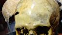 Ce au aflat politistii despre craniul uman gasit la <span style='background:#EDF514'>VASLUI</span>. A fost deschis un dosar penal
