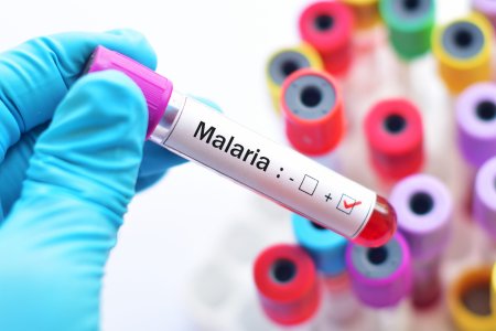 Malaria rezistenta la <span style='background:#EDF514'>MEDICAMENTE</span>, o noua amenintare!