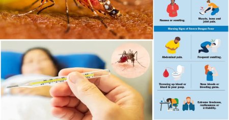 Febra Dengue. Cum sa iti salvezi viata si sa previi infectia severa: semnele timpurii