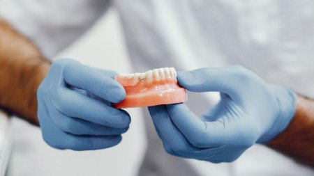 Implant dentar - tot ce trebuie sa stii despre aceasta solutie moderna de restaurare dentara