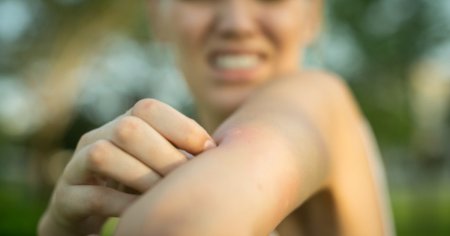 Creste numarul imbolnavirilor cu virusul West Nile. De ce ne inteapa <span style='background:#EDF514'>TANTARI</span>i si cum se face starpirea lor in Bucuresti VIDEO