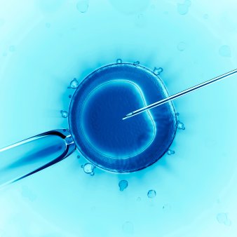 Business Magazin. Cine este in spatele clinici de fertilizare in vitro Embryos, un business de 6,5 milioane de EUR care a contribuit la nasterea a pete 800 de copii prin tehnici FIV