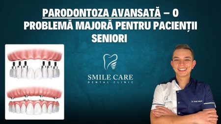 Studiu SMILE CARE: Parodontoza avansata - o problema majora pentru pacientii seniori 