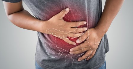 Epidemia de cancer colorectal la persoanele sub 50 de ani: simptomele pe care medicii le-au ratat. Alimentul comun care ar putea cauza criza