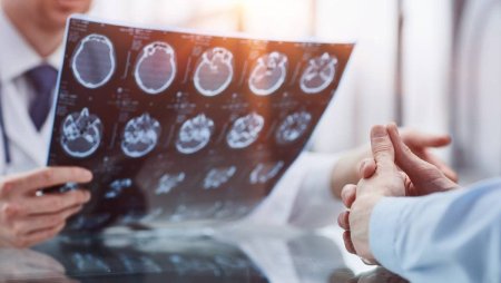 Ipoteza revolutionara: Alzheimerul ar putea fi declansat de infectii virale