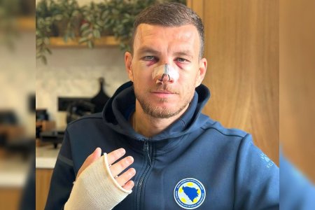 Edin Dzeko, aparitie socanta dupa ce Mihai Popescu i-a dat un sut in fata. Mario Balotelli a intervenit